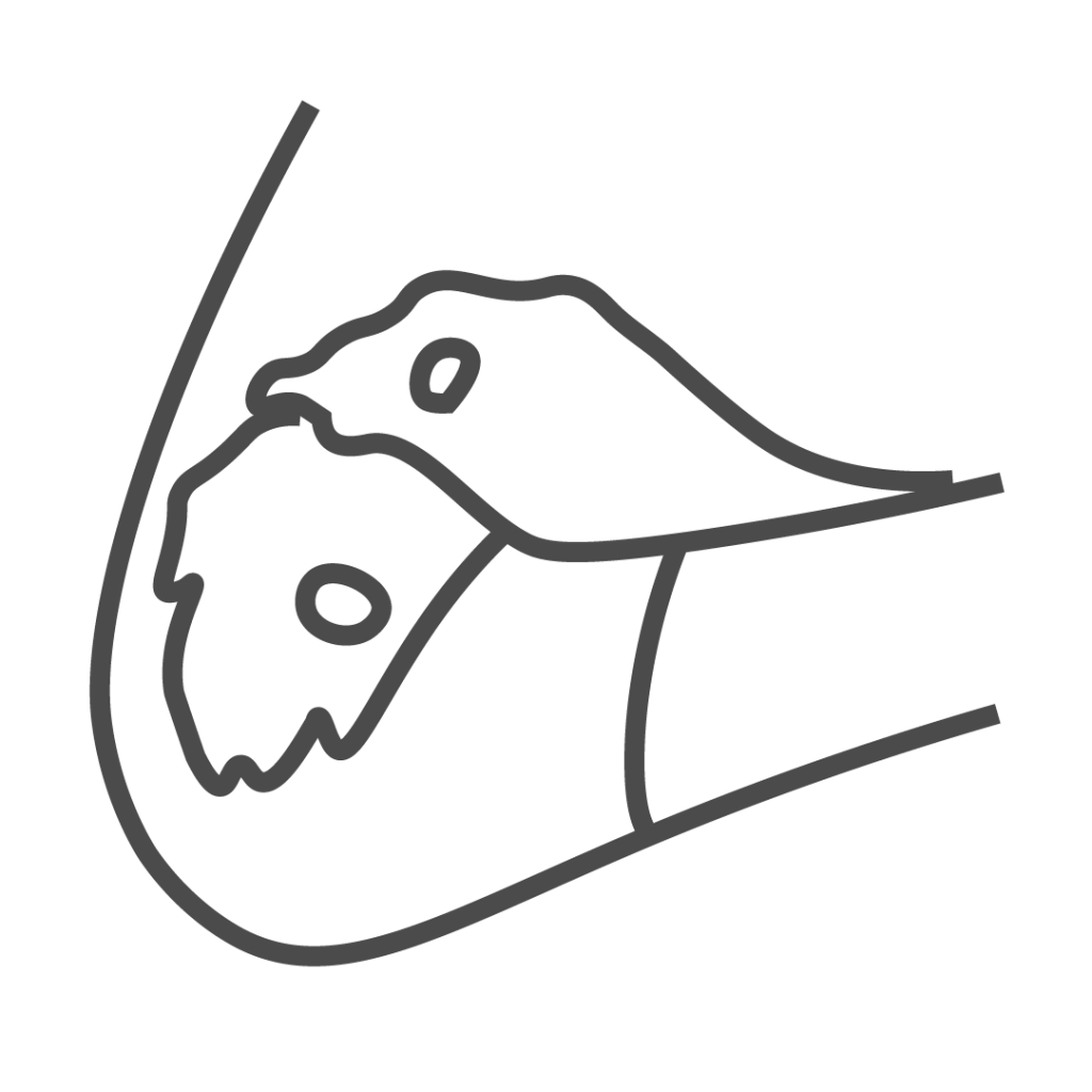 Parterapi